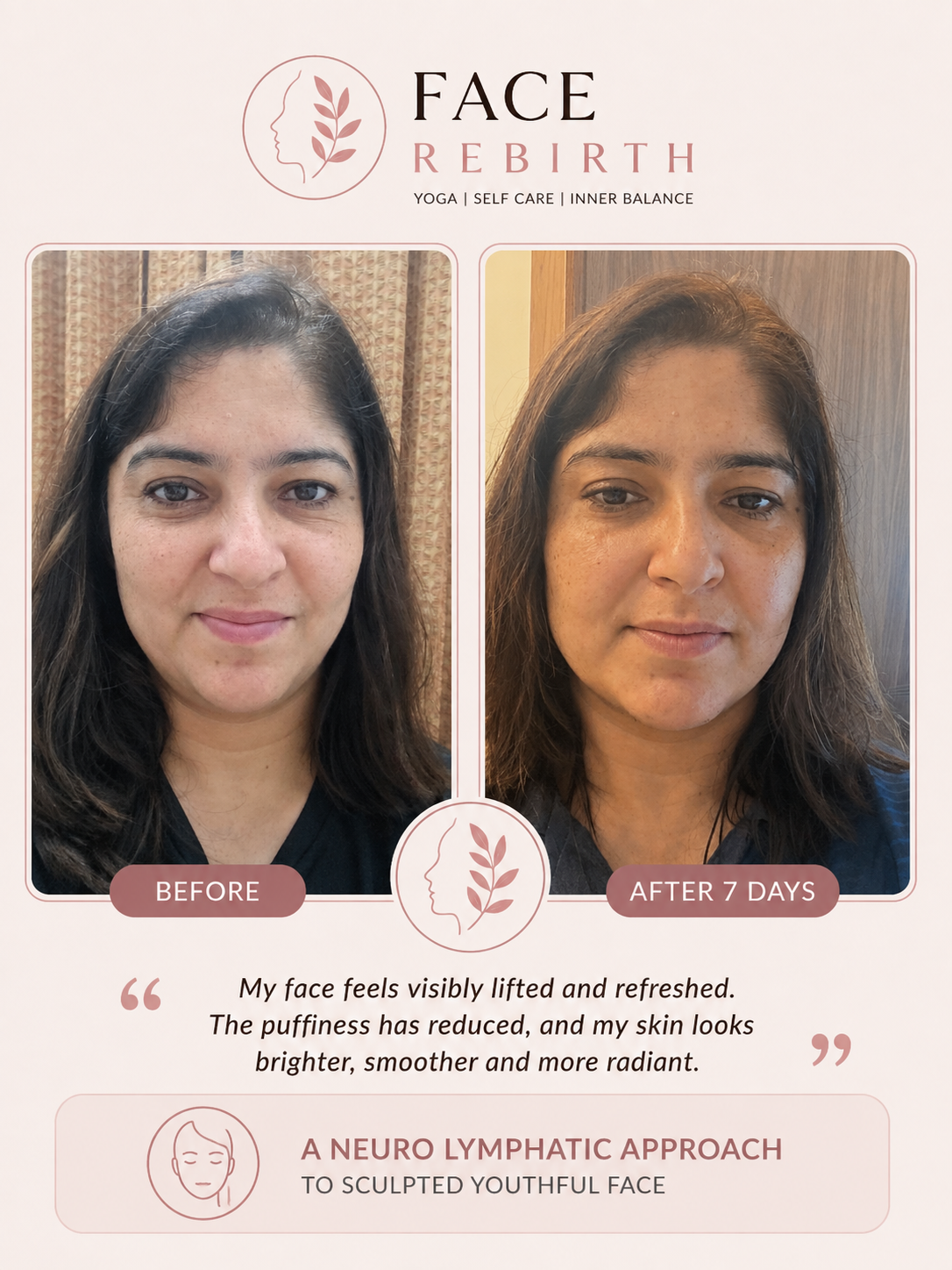 Participant before and after seven days, sharing that her face feels lifted and refreshed and her skin looks brighter.